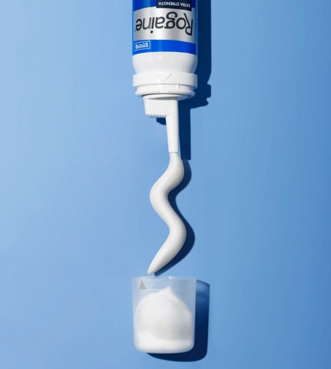 탈모의 골든타임 / 출처: 로게인 공식 홈페이지