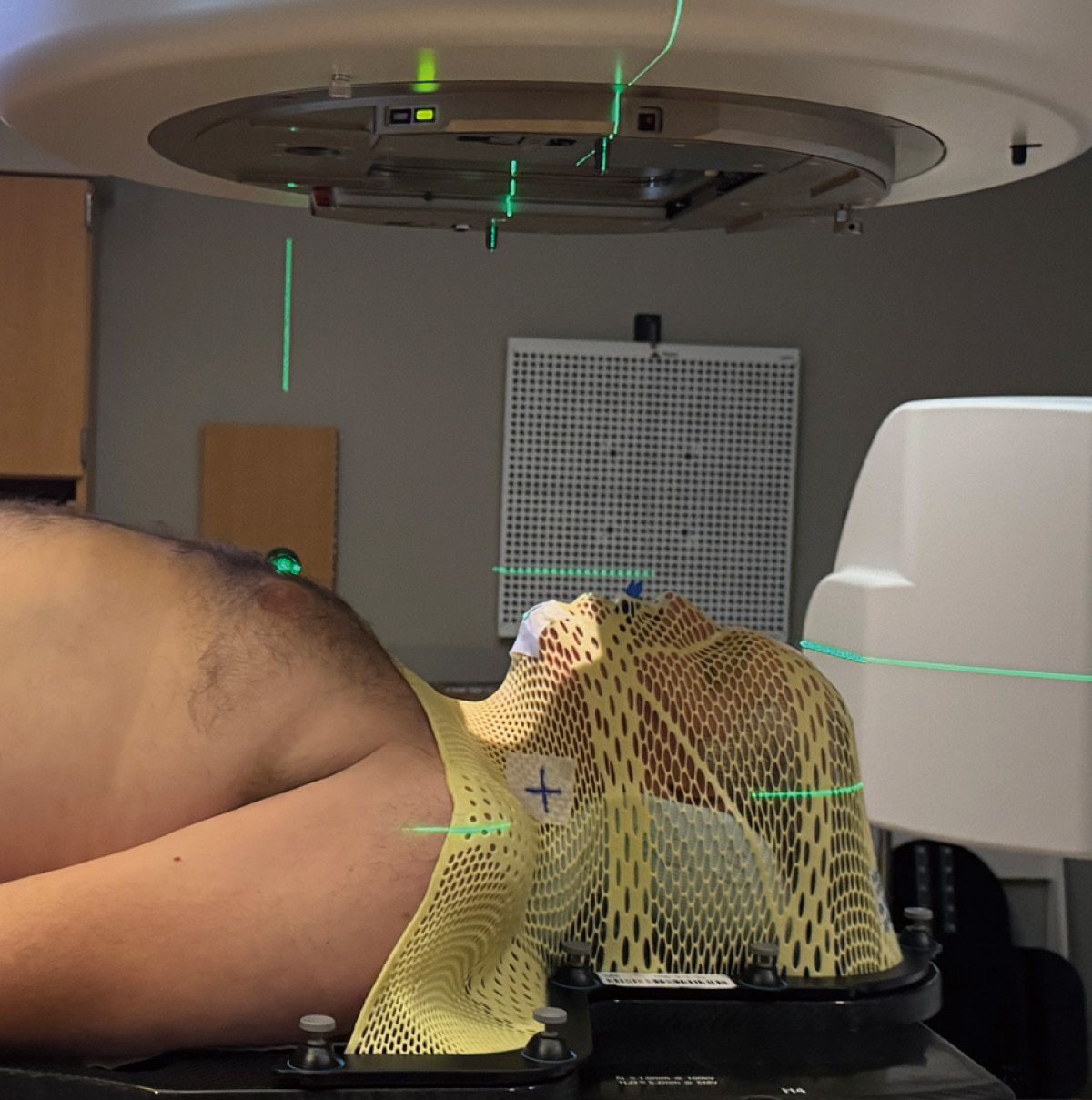 방사선 치료를 받고 있는 크로스. 