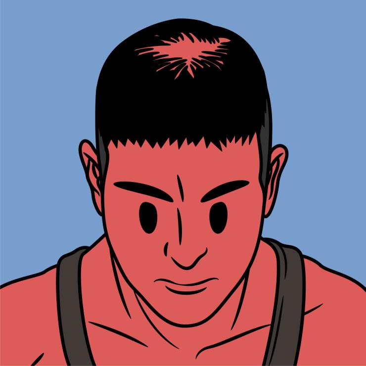 탈모 자가 진단 정수리 탈모