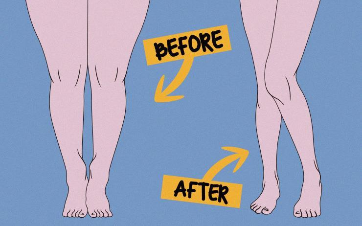 하체비만 탈출 운동